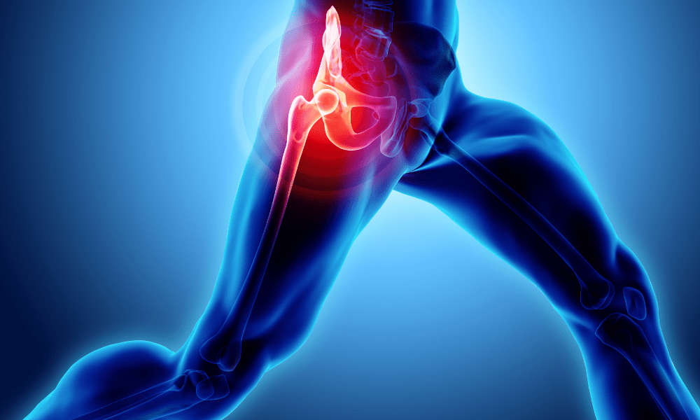 走った時の股関節痛