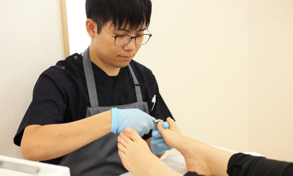 伊勢崎アシカ接骨院の巻き爪矯正
