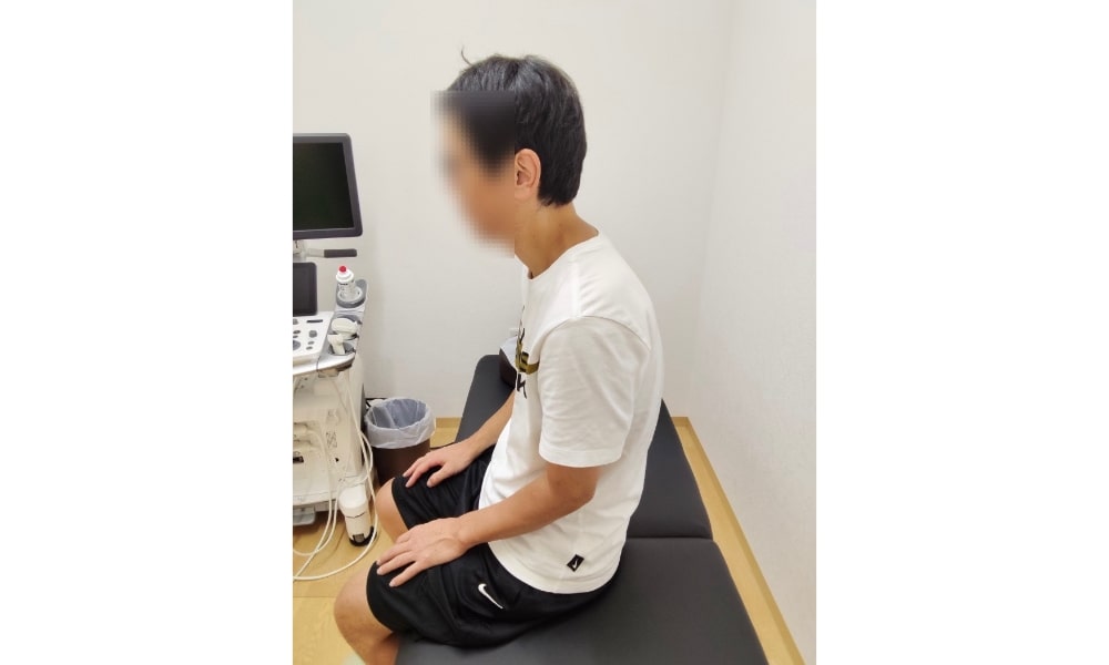 猫背矯正前の姿勢写真